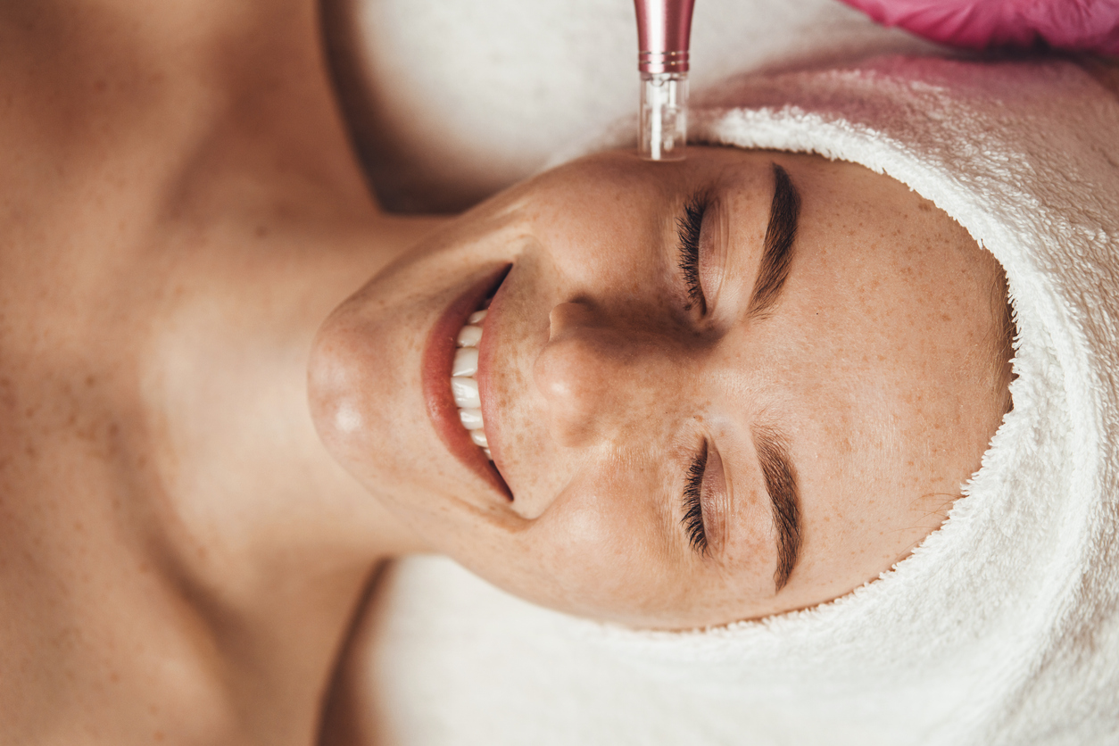 Microneedling
