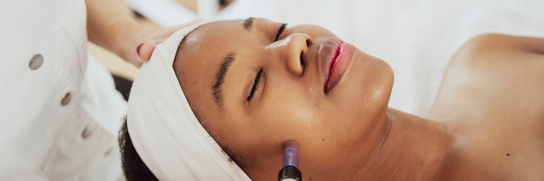 Microneedling