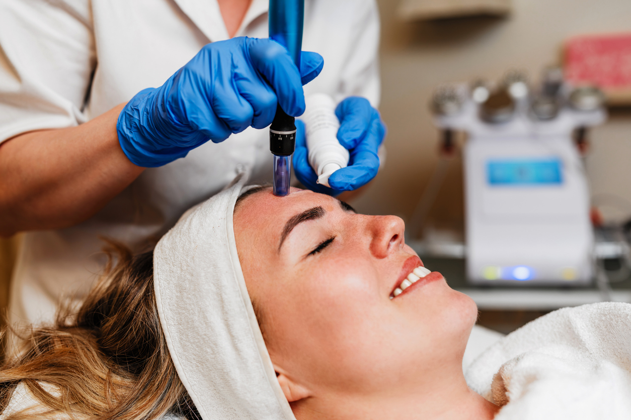 Microneedling